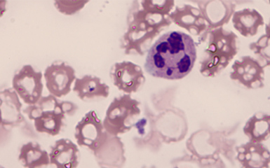 血液中的白细胞观察的重要工具—广州明美自主研发的显微镜相机MD50