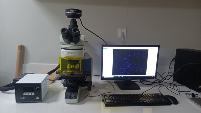荧光显微镜观察 HER-2:癌症早筛的关键指标