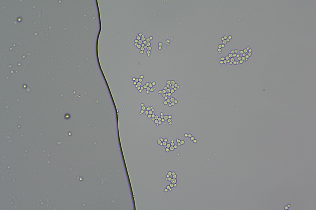 酵母菌2.jpg